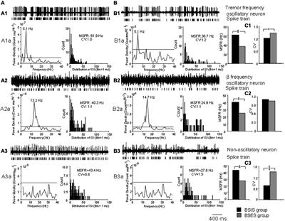 Differences in subthalamic oscillatory activity in the two hemispheres associated with severity of Parkinson’s disease